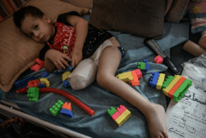 Amputated children QNN